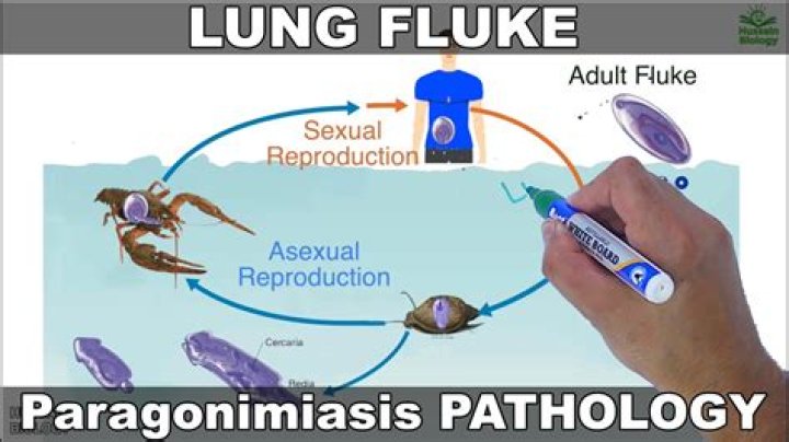 What causes lung fluke